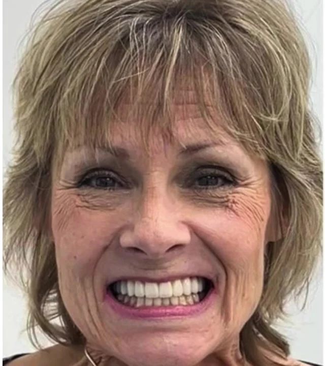 Smile Again NJ patient after treatment — case 1