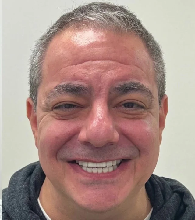 Smile Again NJ patient after treatment — case 2