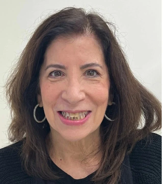 Smile Again NJ patient before treatment — case 3