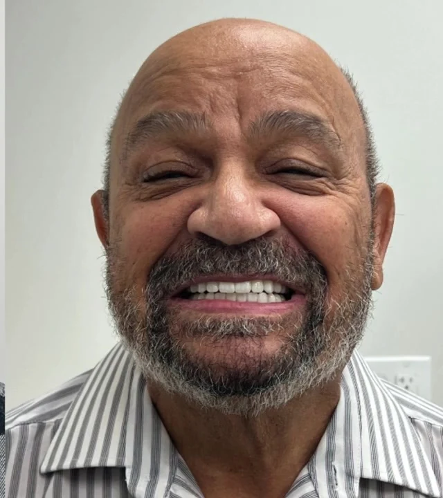 Smile Again NJ patient after treatment — case 5