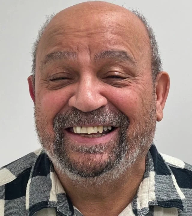 Smile Again NJ patient before treatment — case 5