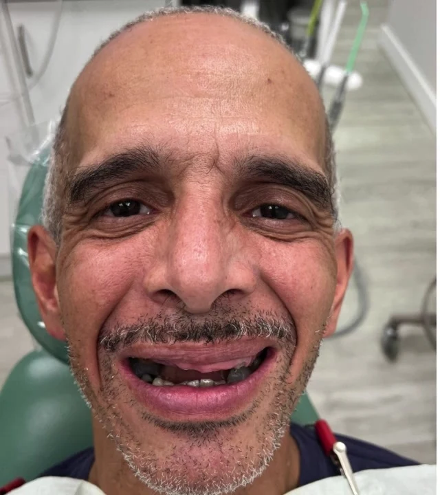 Smile Again NJ patient before treatment — case 8