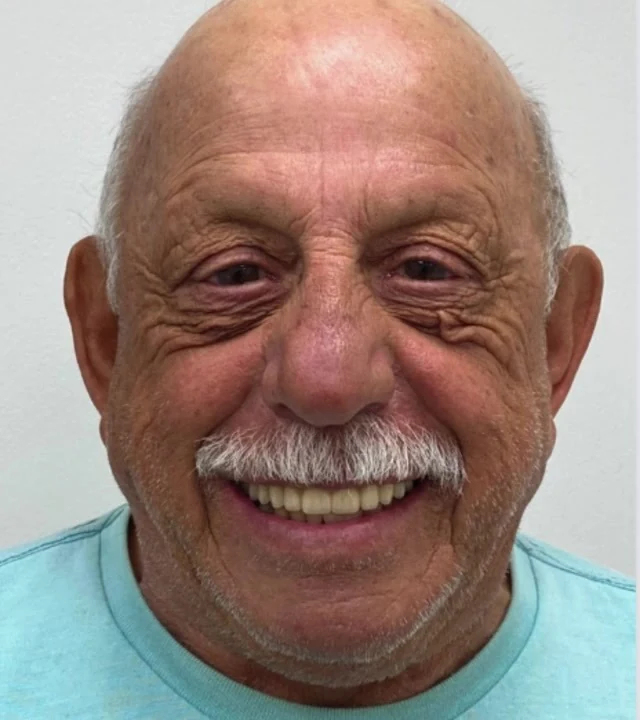 Smile Again NJ patient after treatment — case 9