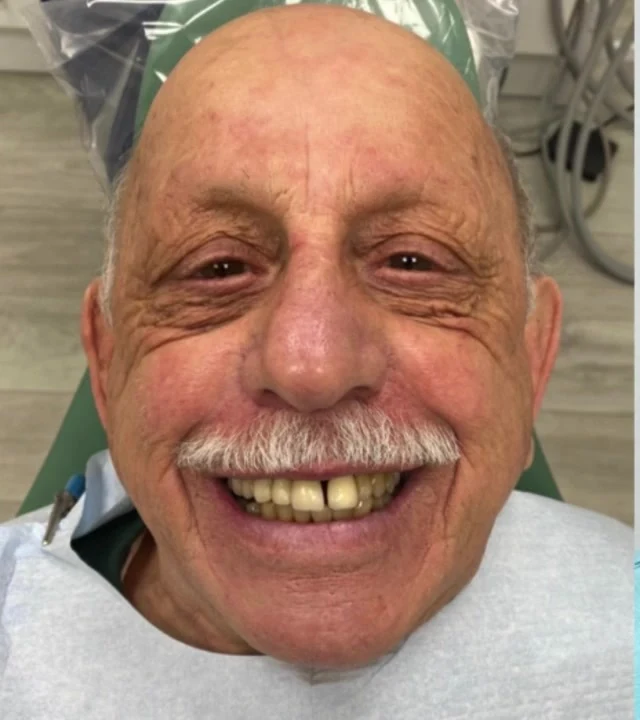 Smile Again NJ patient before treatment — case 9