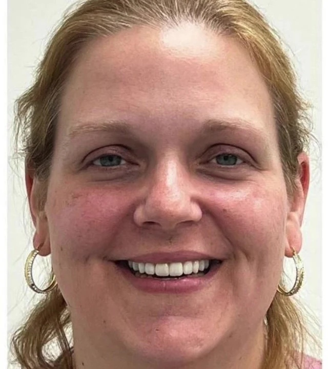 Smile Again NJ patient after treatment — case 10