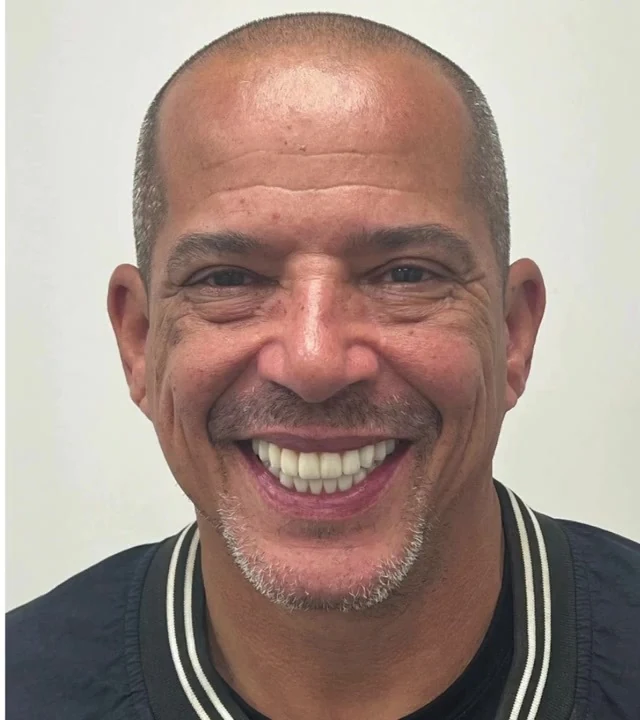 Smile Again NJ patient after treatment — case 11