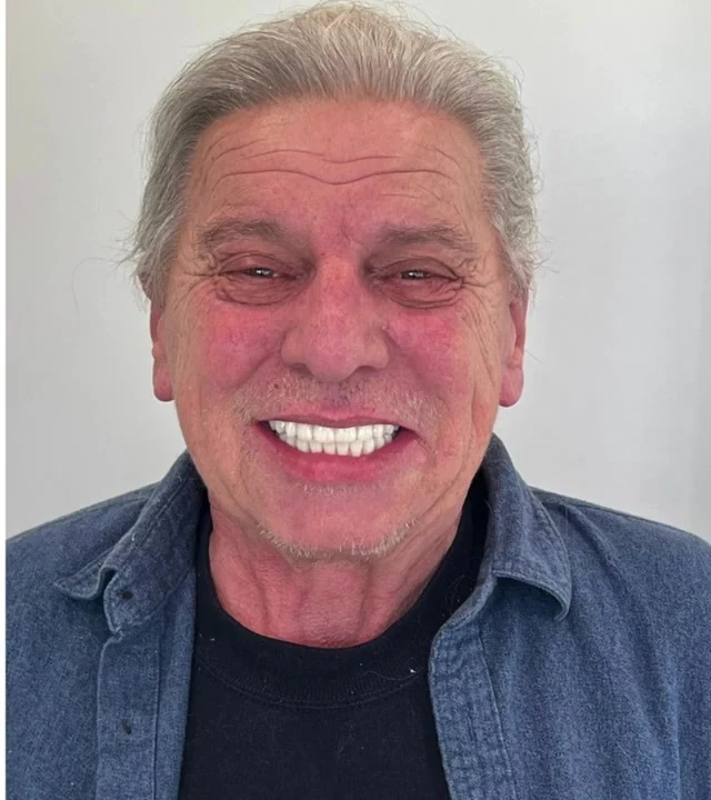 Smile Again NJ patient after treatment — case 12
